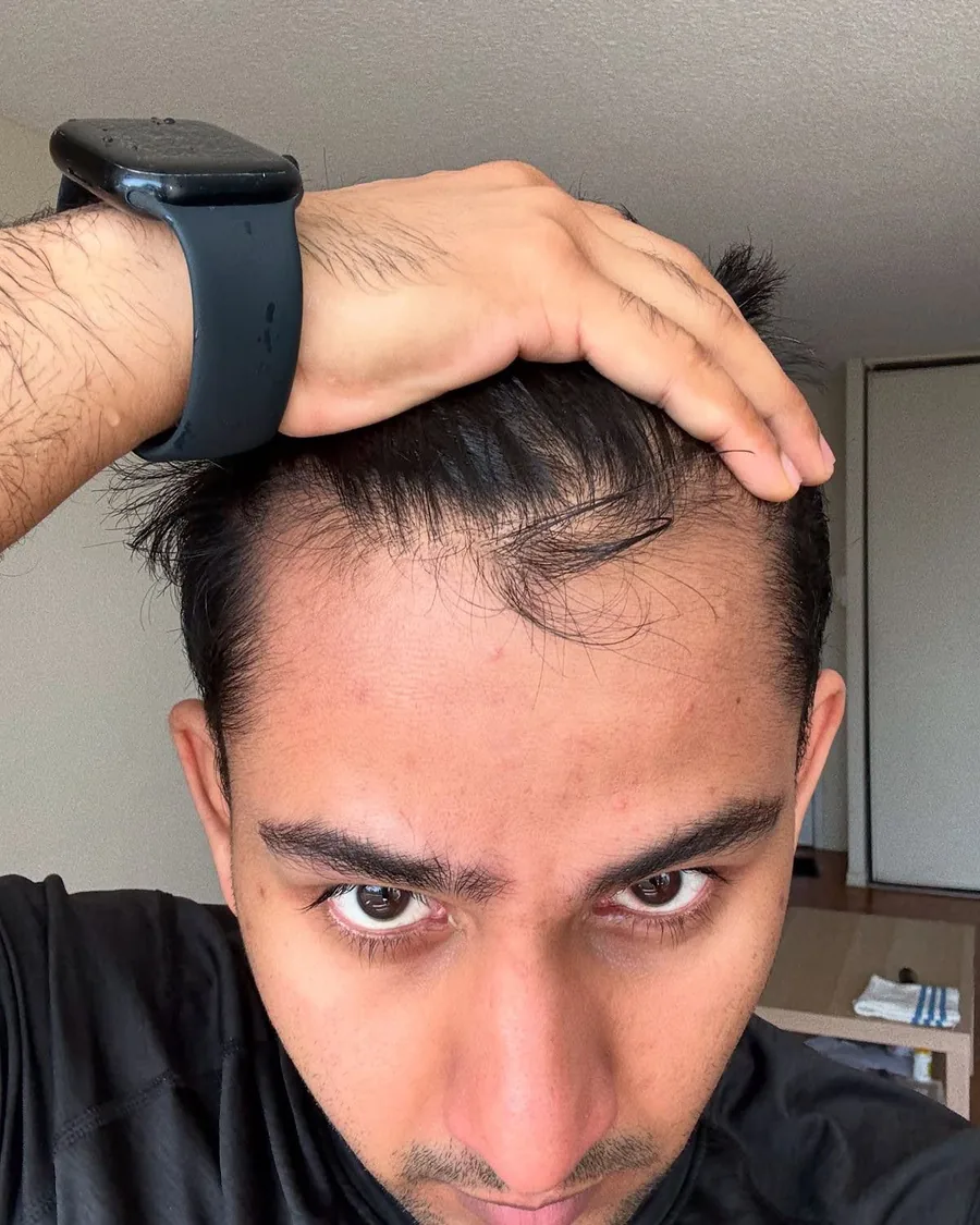 A man pushing his hair back with one hand